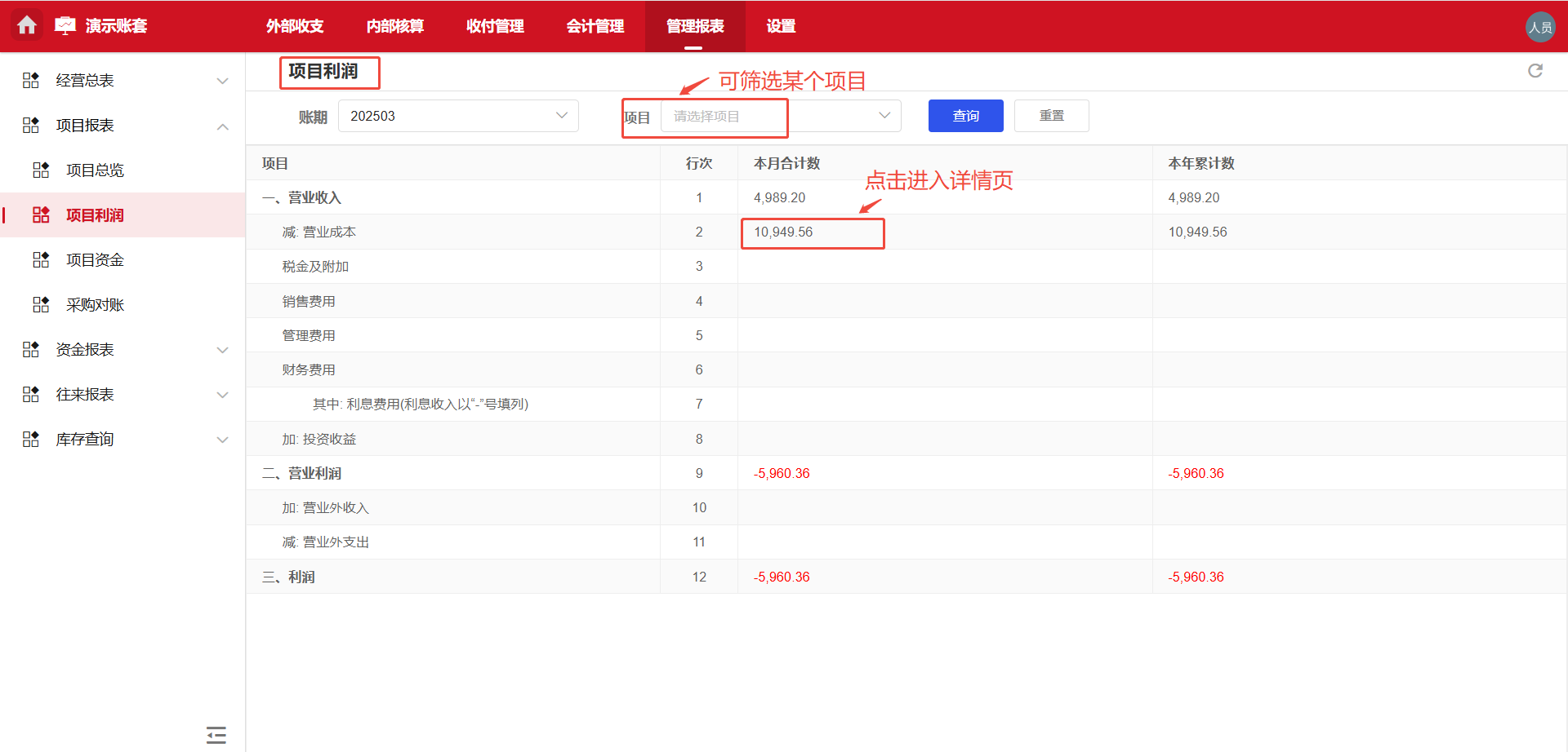 管理报表-项目利润